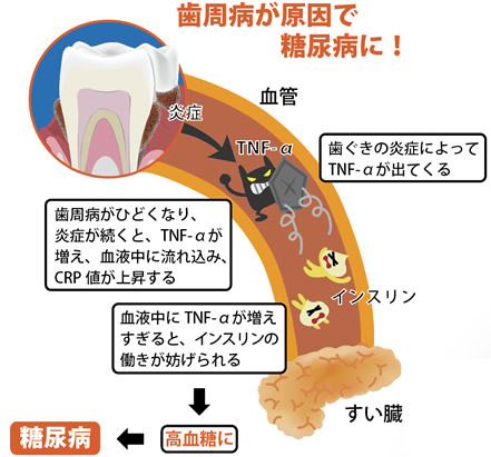 健康で長生きのための４つの秘訣