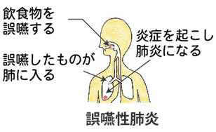 訪問歯科